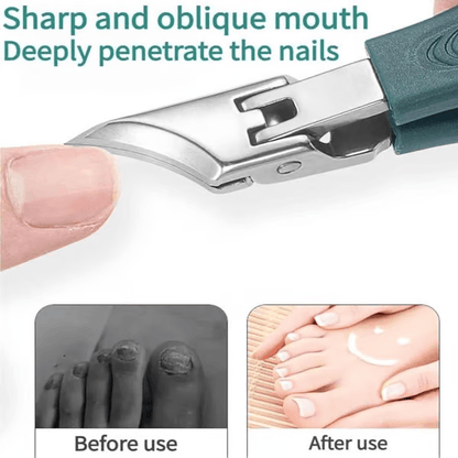 ⏳Begrenzte Zeit 50% Rabatt💥Von Podologen empfohlener Nagelknipser – Ergonomisches, abgewinkeltes Design für Zehennägel und eingewachsene Nägel